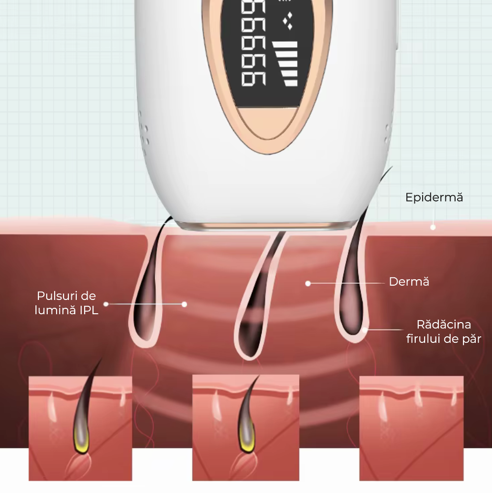 Epilator IPL cu cristal safir