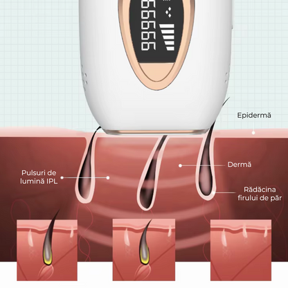 Epilator IPL cu cristal safir