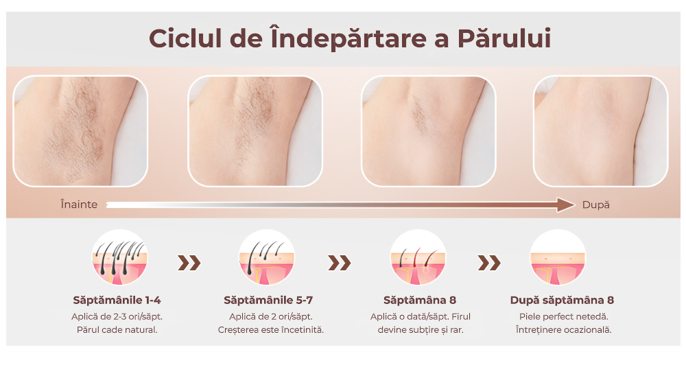 Epilator IPL Freezing Point