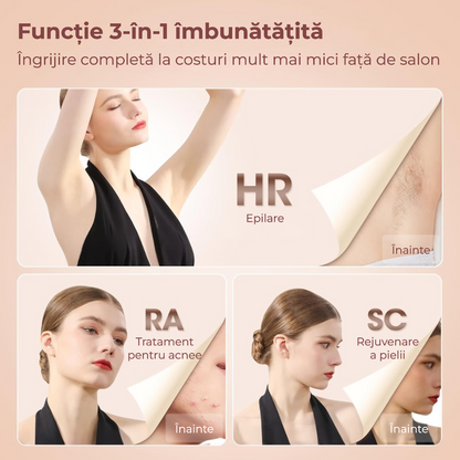 Epilator IPL Freezing Point