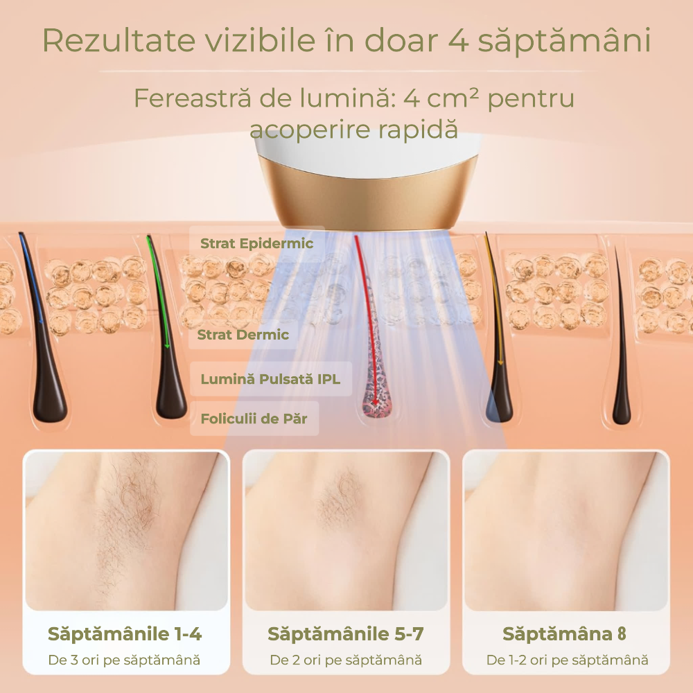 Epilator IPL Freezing Point