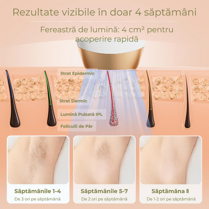 Epilator IPL Freezing Point